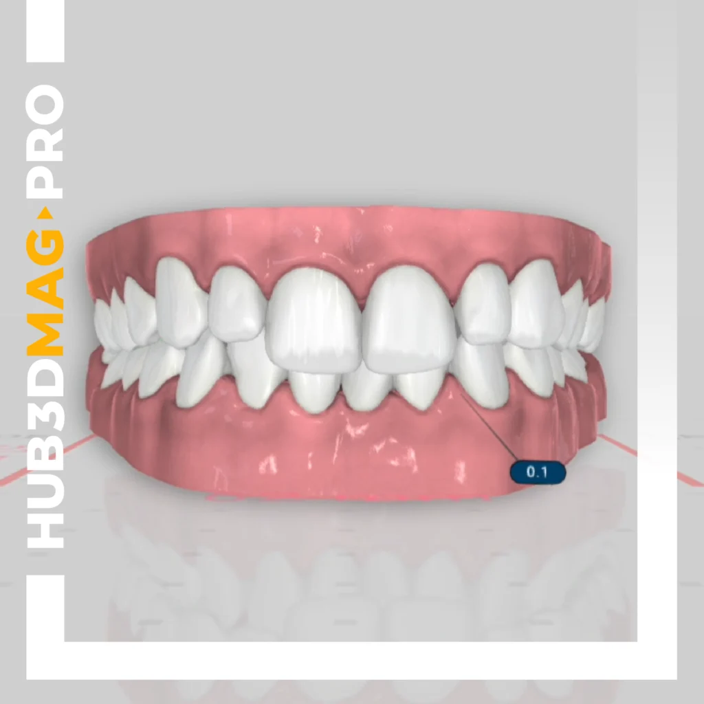 Copertina corso Titan parte 2 HUB3D Orthodontics