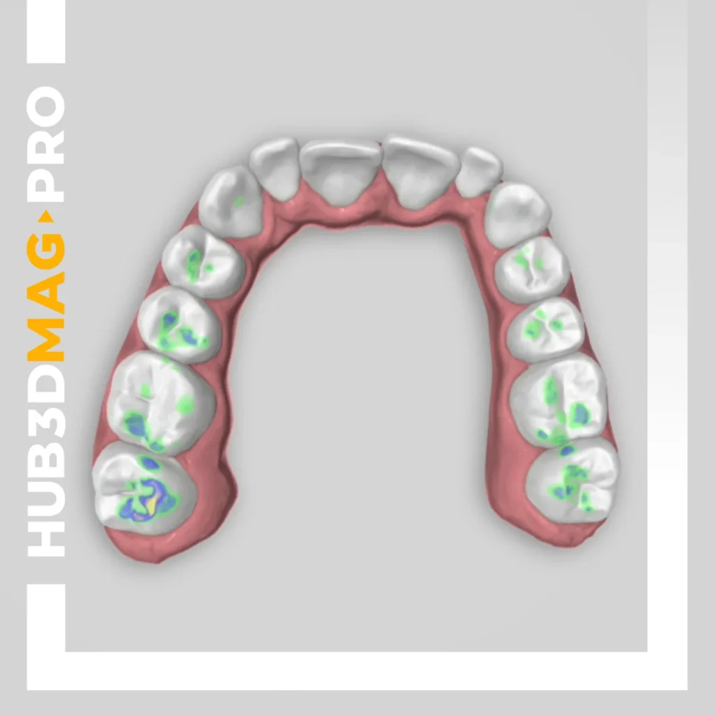 Copertina corso Titan parte 3 HUB3D Orthodontics